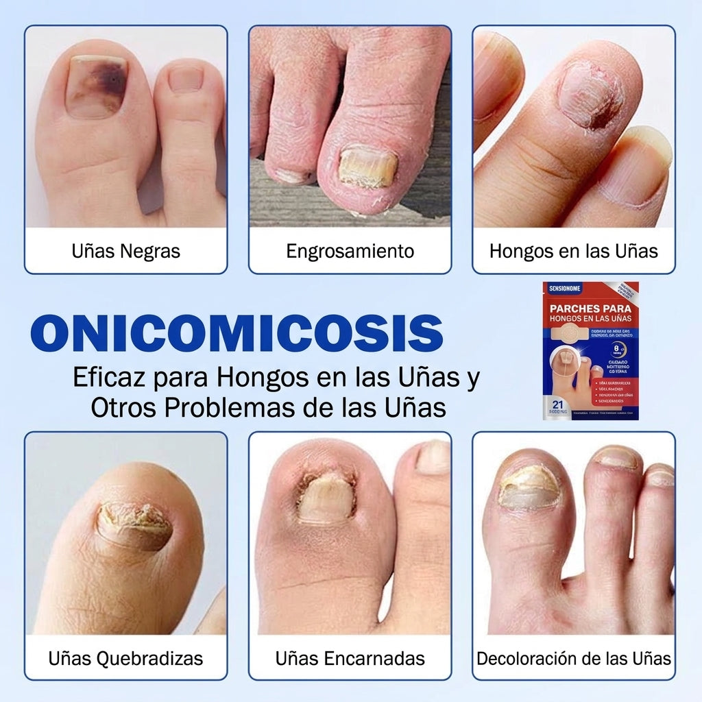Parches para Tratamiento de Hongos en las Uñas de los Pies – Reparación Nocturna Extra Fuerte (21 Unidades)